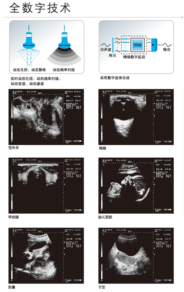 凯信超声诊断仪KX2000B 推车式 