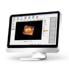 理邦超声影像管理系统 UMS100多种图像采集功能