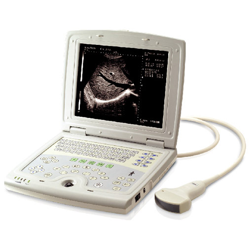 凯信超声诊断仪KX5000 笔记本式