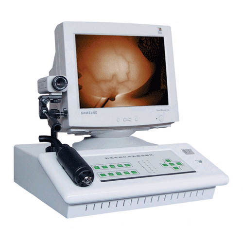 圣普红外乳腺诊断仪SPR-1A型 