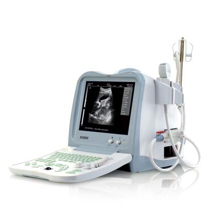 凯信全数字B型超声诊断仪KX2600型 (09版) 