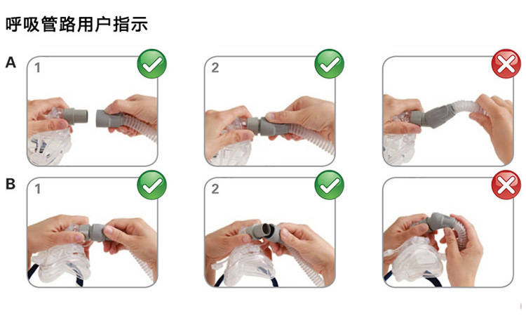 瑞思迈呼吸机VPAP IV 全自动双水平 治疗慢阻肺、肺心病、呼吸功能不全