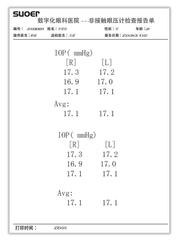 索维 非接触眼压计 SW-5000