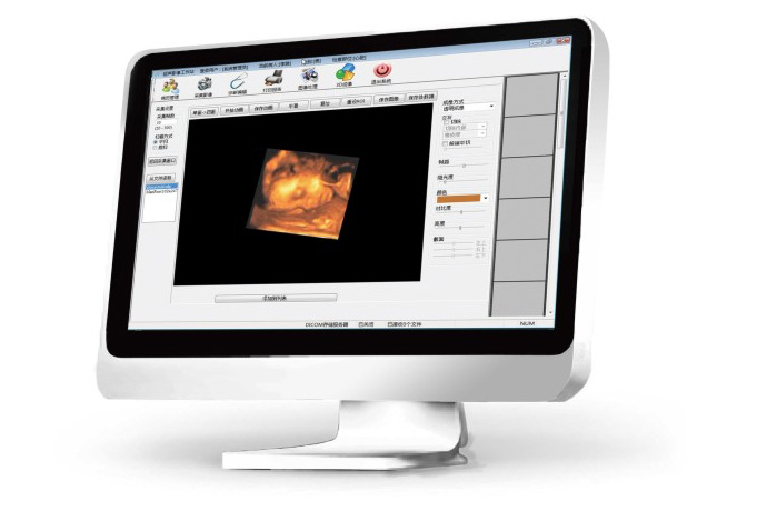 理邦  超声影像管理系统  UMS100