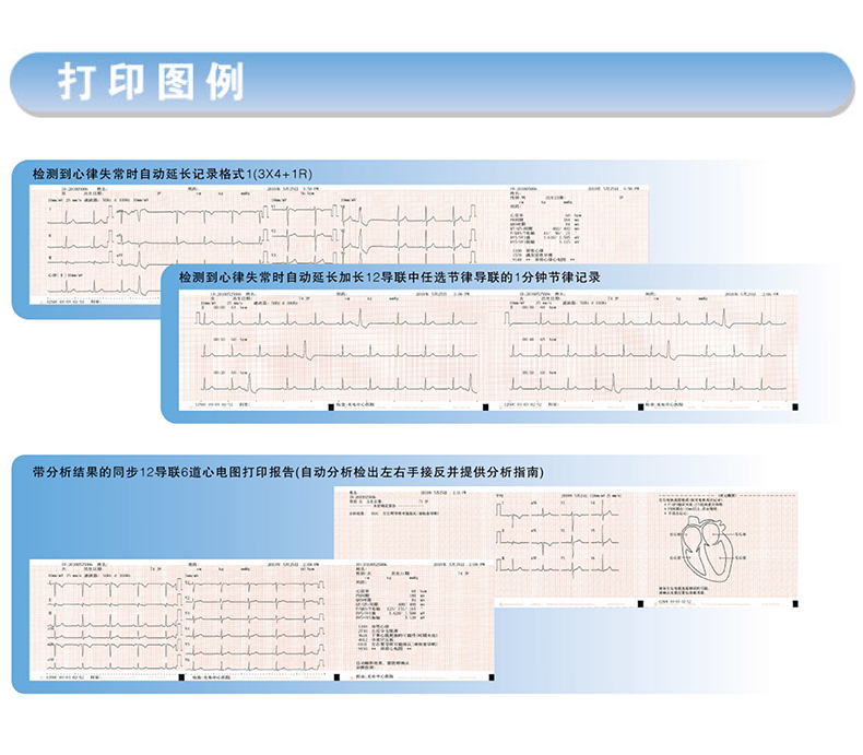 光电 多道心电图机 ECG-1250C 六道自动分析心电图机