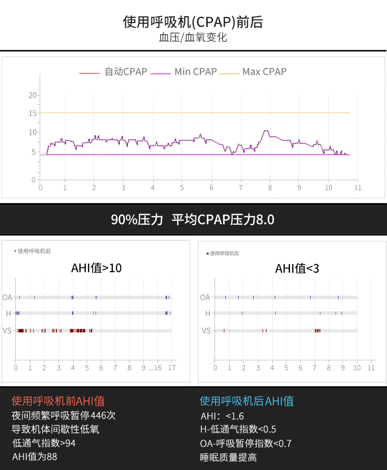 飞利浦伟康呼吸机REMstar Auto 557P全自动 单水平 睡眠呼吸暂停