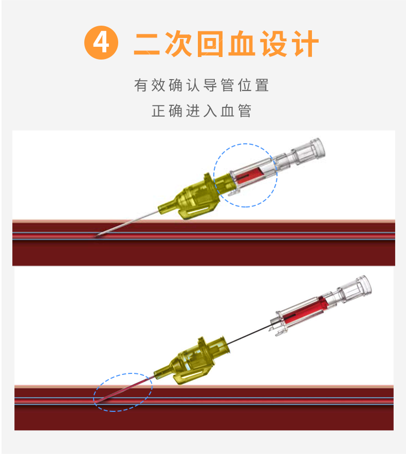 德国贝朗 Introcan-W 英初康 动静脉留置针（带翼） 