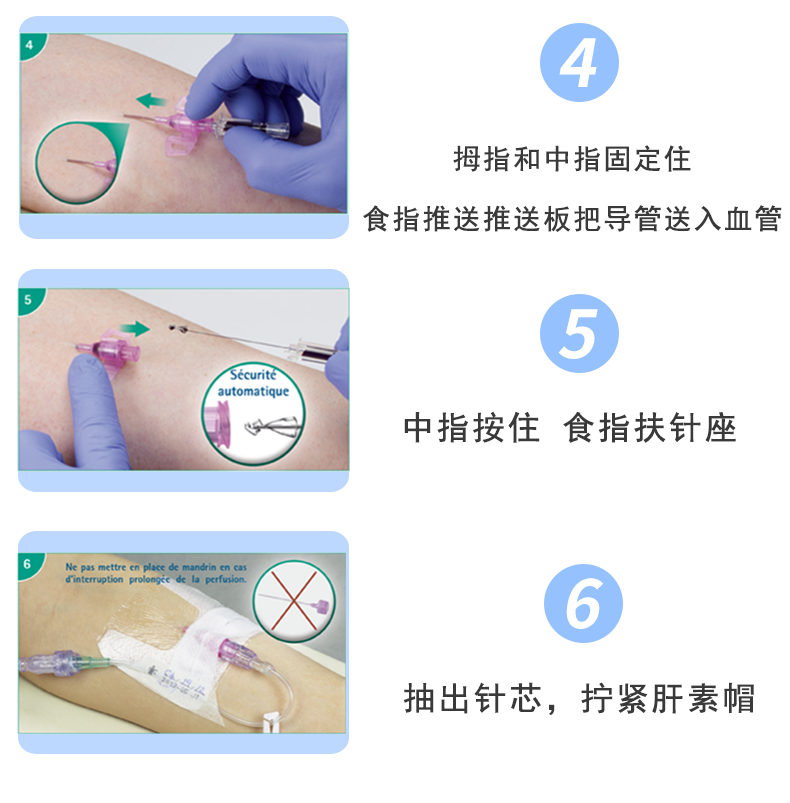 德国贝朗Introcan Safety-W 英全康18G 安全型 带翼动静脉留置针