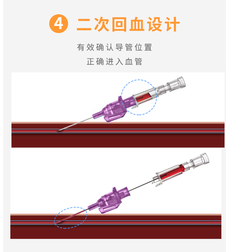 英全康20G动静脉留置针