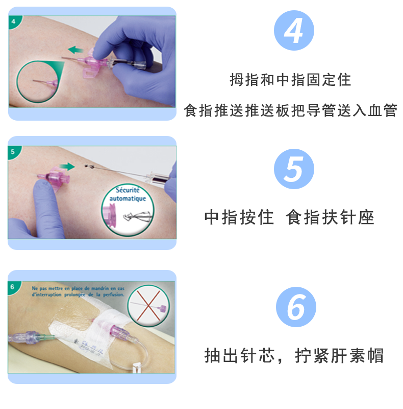 英全康20G动静脉留置针