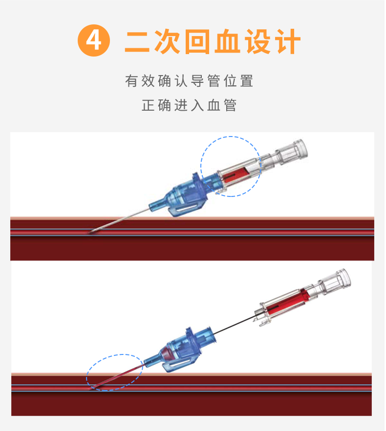 英全康22G动静脉留置针