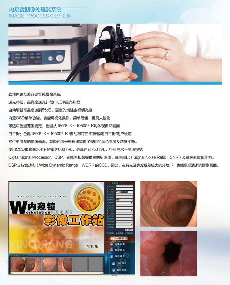 图治 电子上消化道内窥镜 ESE-360 产品简介 图治 电子上消化道内窥镜 ESE-360 产品简介
