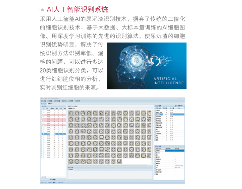 天海全自动尿液分析工作站 UW-2020 产品原理