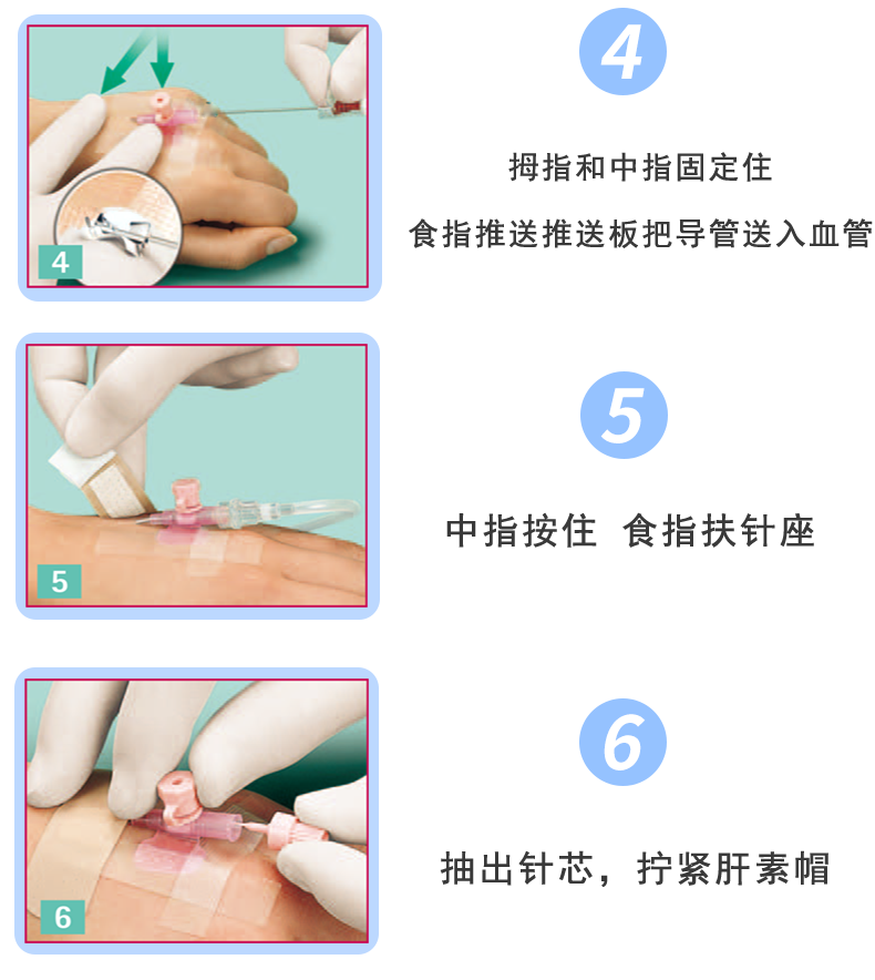 德国贝朗 静脉留置针 Vasofix沃素菲