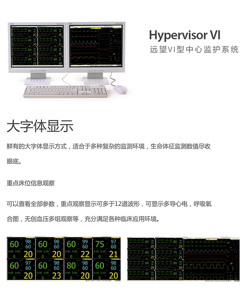 迈瑞 中心监护系统 Hypervisor VI 中央站