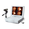 KEJIAN红外乳腺诊断仪AD-1202 便携型精品型