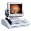 圣普红外乳腺诊断仪 SPR-1A型